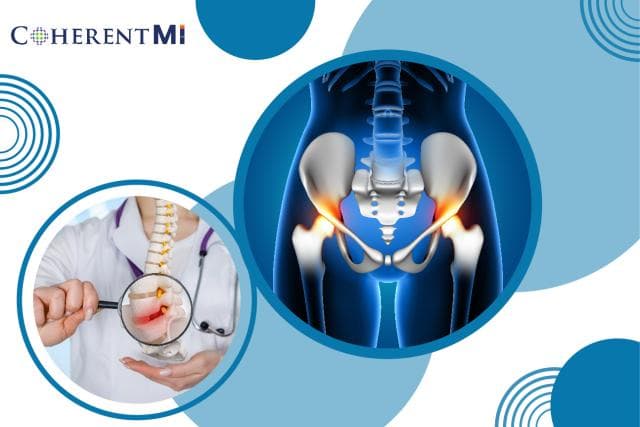 Cover image for Sacroiliac Joint Fusion: A Guide to this Life-Changing Back Procedure