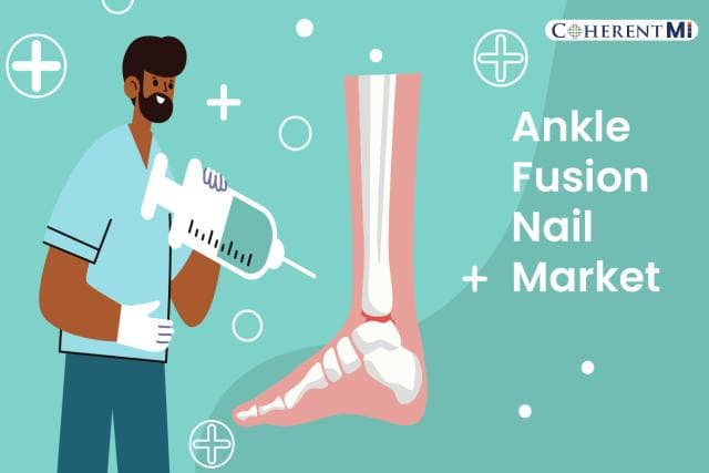 Cover image for Ankle Fusion Surgery: A Revolutionary Procedure to Fix Ankle Problem